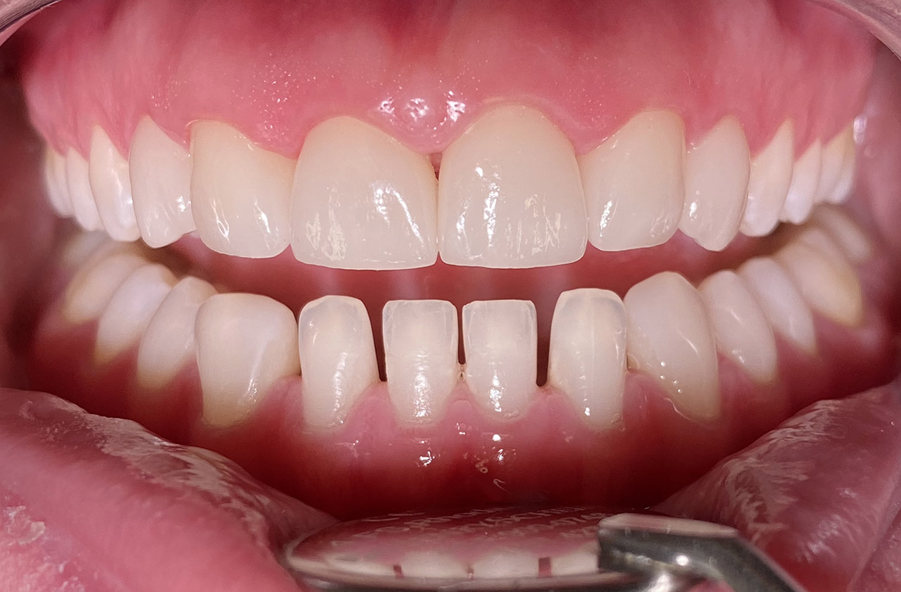 Ästhetische Zahnheilkunde / 10