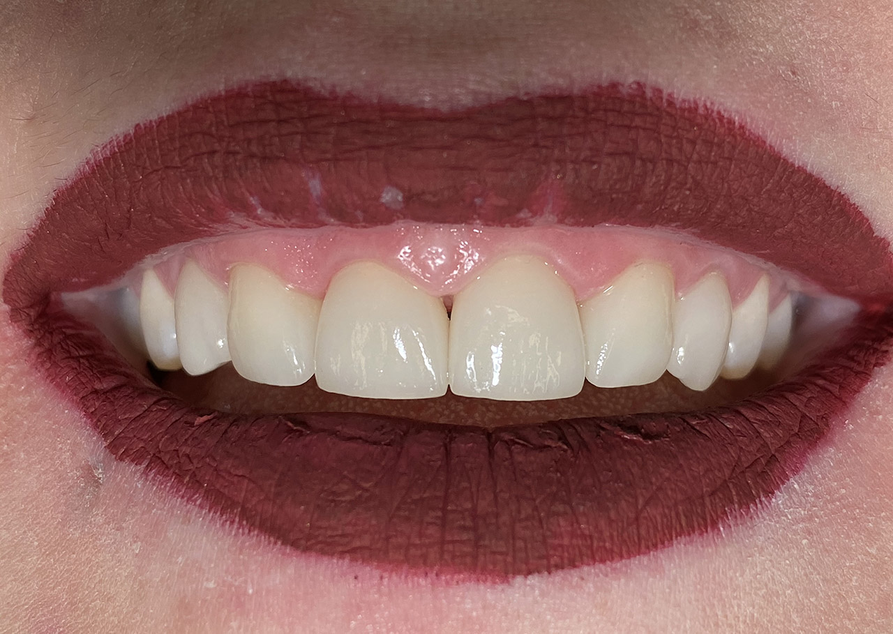 Ästhetische Zahnheilkunde / 11